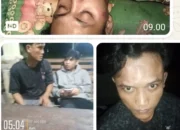 Warga Kasang Melintang Laporkan Dugaan Penganiayaan ke Polsek Air Hitam, Ketua Pemuda Minta Kasus Segera Dituntaskan